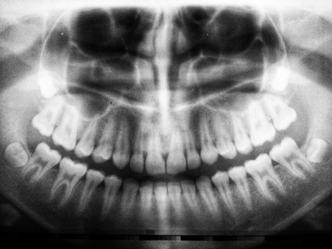 dental implant success rate chart, osseointegration xray, peri-implantitis comparison